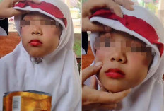 Waduh Kasian Banget, Diduga Bocah SD Menjadi Korban Kekerasan oleh Ibu Kandungnya 