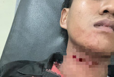 Atlet Karate Palembang Luka Serius Akibat Tali Layangan, Butuh Rp40 Juta untuk Operasi