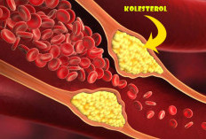 Kolesterol Kumat, Tenang Ini Solusinya Bisa Menurunkan 