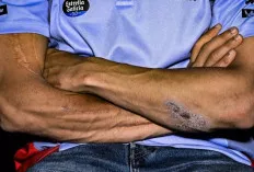 Luka Marc Marquez jadi Sorotan, Seri ke-6 MotoGP Catalunya 