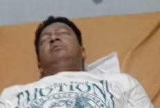 Pria di Palembang Kritis Disiram Air Keras di Pesta, Mata Nyaris Buta