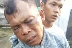 Pasal Hutang, Pria Ini Nyaris Babak Belur Dikeroyok Istri dan Anak Tiri