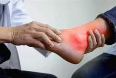 Bolehkah Penderita Asam Urat Dikompres Dengan Air Dingin? Yuk Simak Penjelasanya 