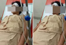Diduga Cekcot Mulut, LC Nyaris Tewas Usai Ditikam Rekannya Sendiri 