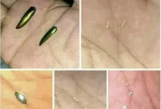 Susuk, Benarkah Bertuah? Meihat Fakta dan Mitos di Baliknya