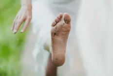 Resah dengan Telapak Kaki Pecah-Pecah Seperti Ada Peta, Begini Caranya Bikin Mulus Kembali