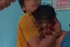 Petani di Musi Rawas Diserang Beruang, Alami Luka Parah di Kepala