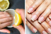 Kabar Baik! Kuku Busuk Diduga Bisa Diatasi dengan Keajaiban Jus Lemon, Begini Caranya