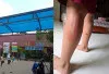 Heboh Dugaan Kekerasan terhadap Siswa SD, Tiga Orang Tua Tempuh Jalur Hukum